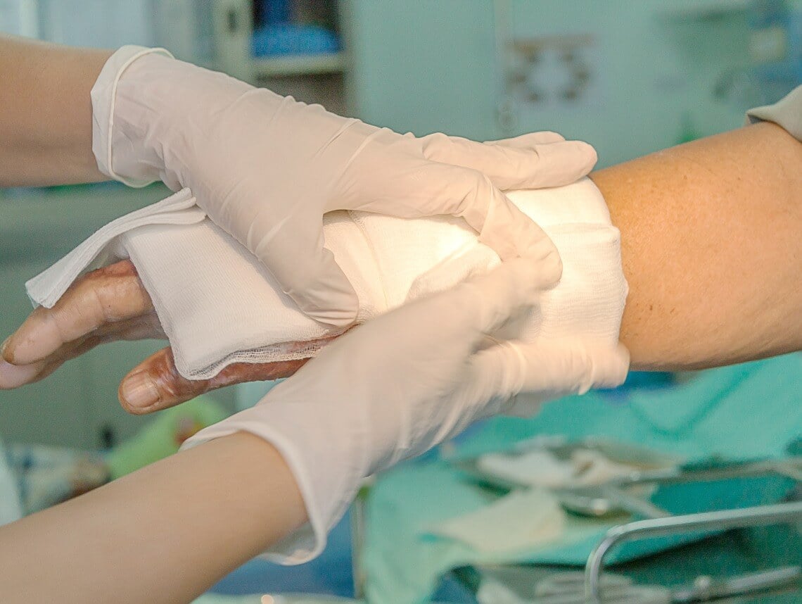 A Complete Guide to Wound Dressing