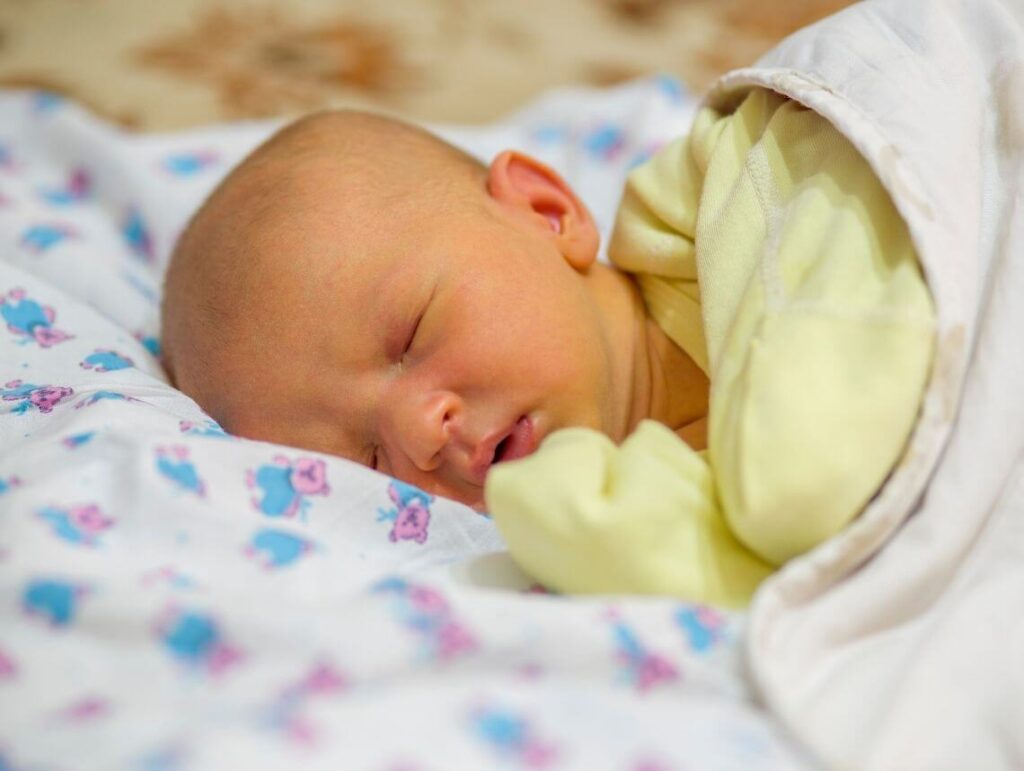 Alagille Syndrome in Children