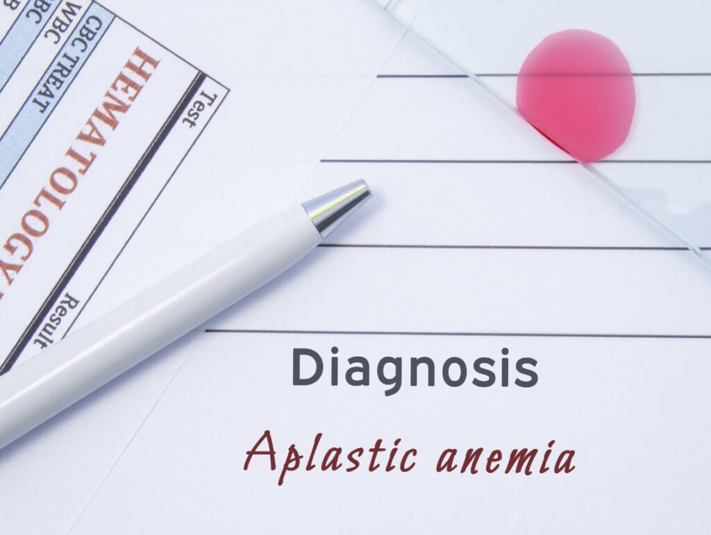 Aplastic Anemia in Children