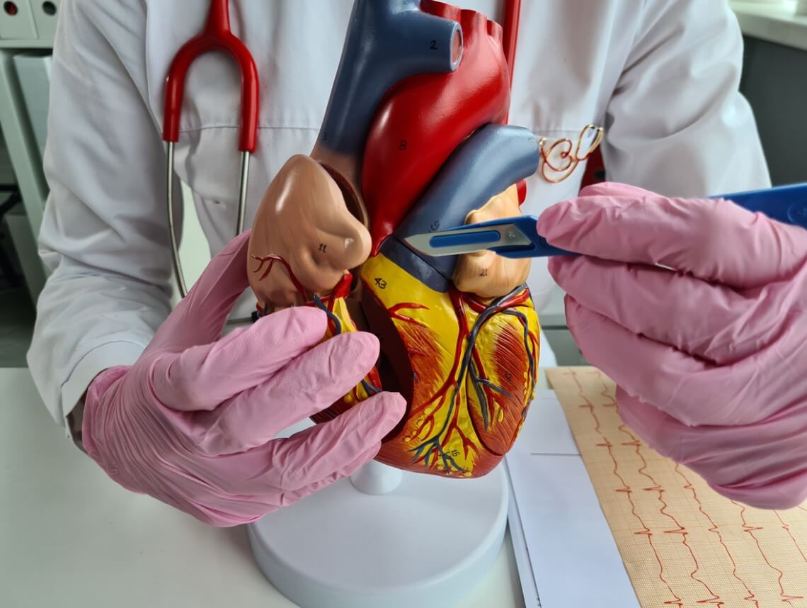 Bicuspid Aortic Valve (BAV) in Children