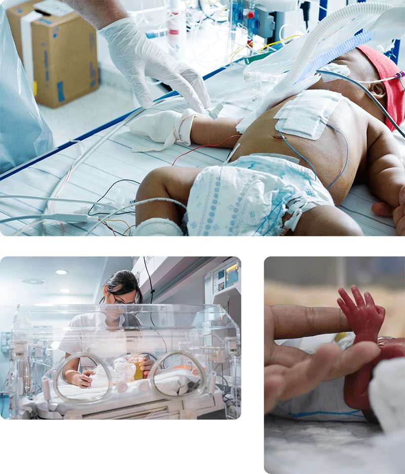 Compassionate Premature Infant Care Services