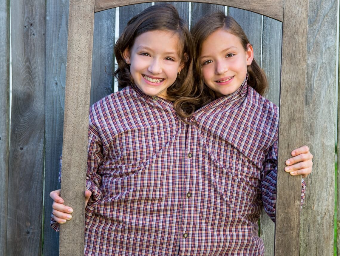 Conjoined Twins