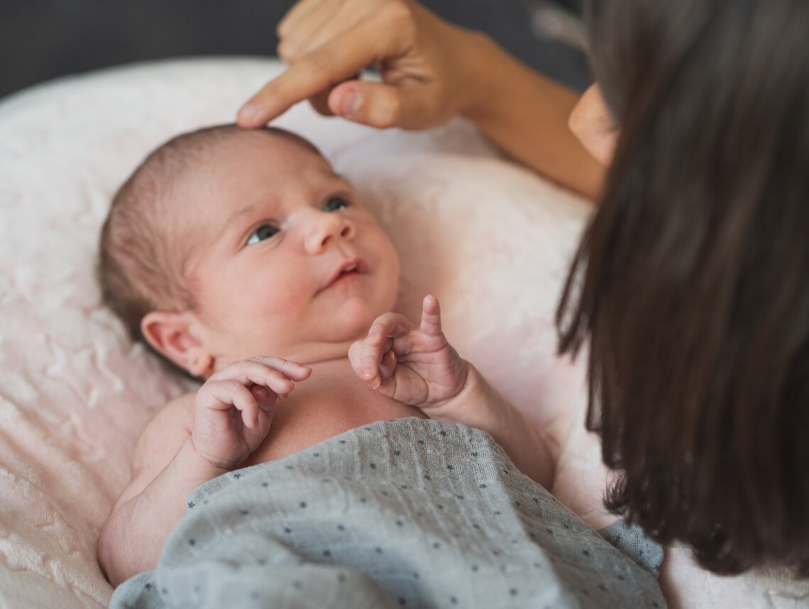 Cradle Cap (Seborrheic Dermatitis) in Infants