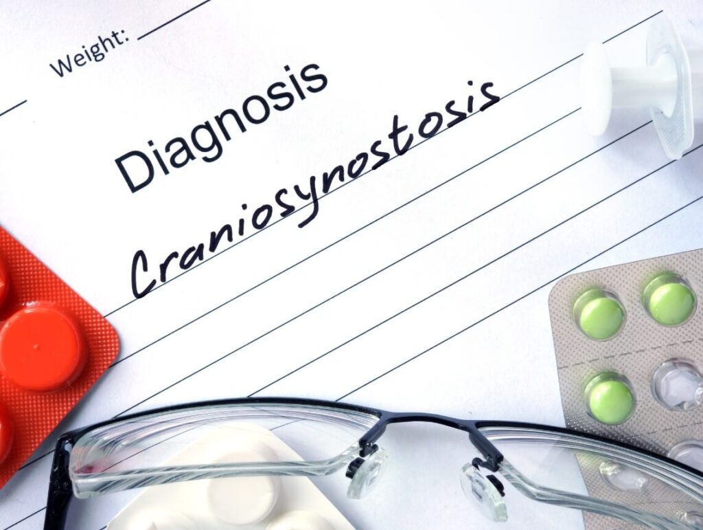 Pediatric Craniosynostosis