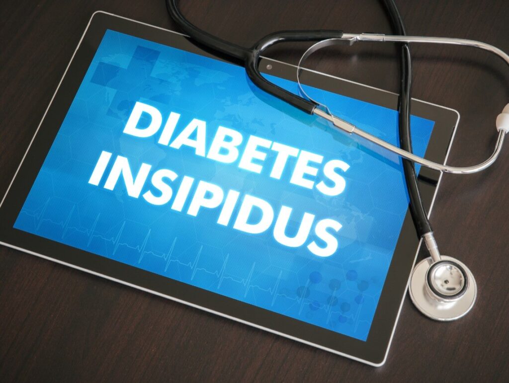 Diabetes Insipidus in Children