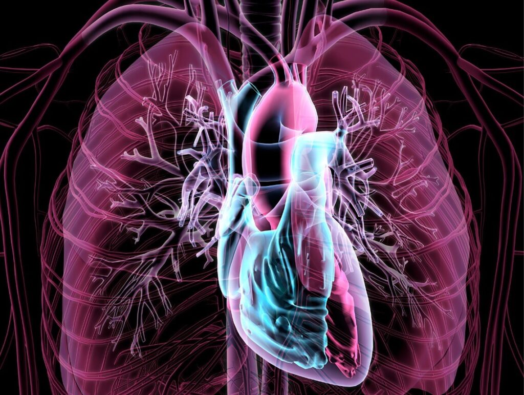 Double-Outlet Right Ventricle in Children