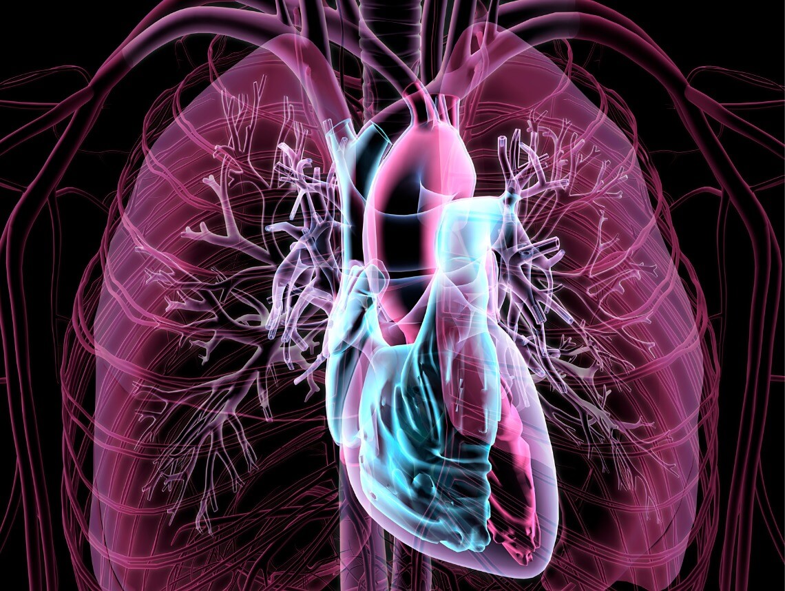 Double-Outlet Right Ventricle in Children
