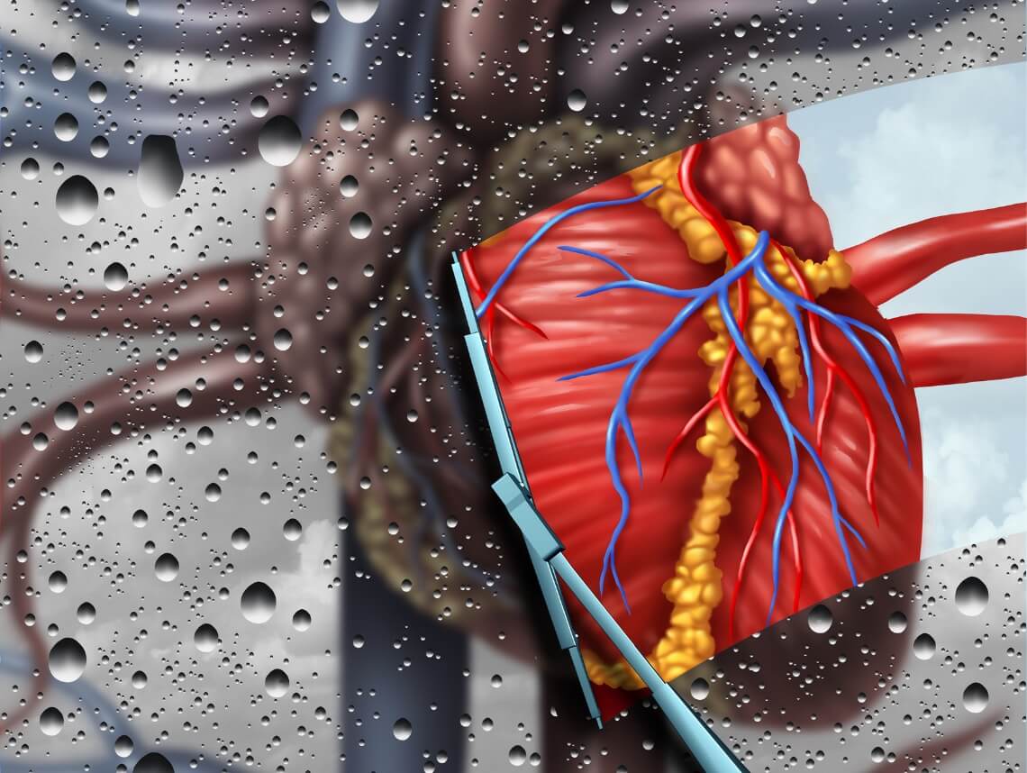 Double-inlet Left Ventricle in Children