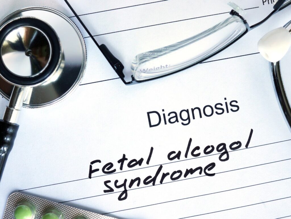 Fetal Alcohol Syndrome (FAS)