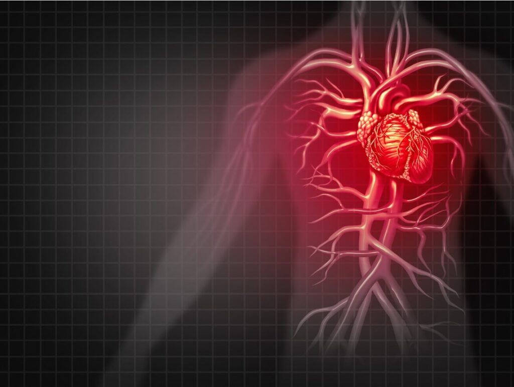 What Is Heart Disease?