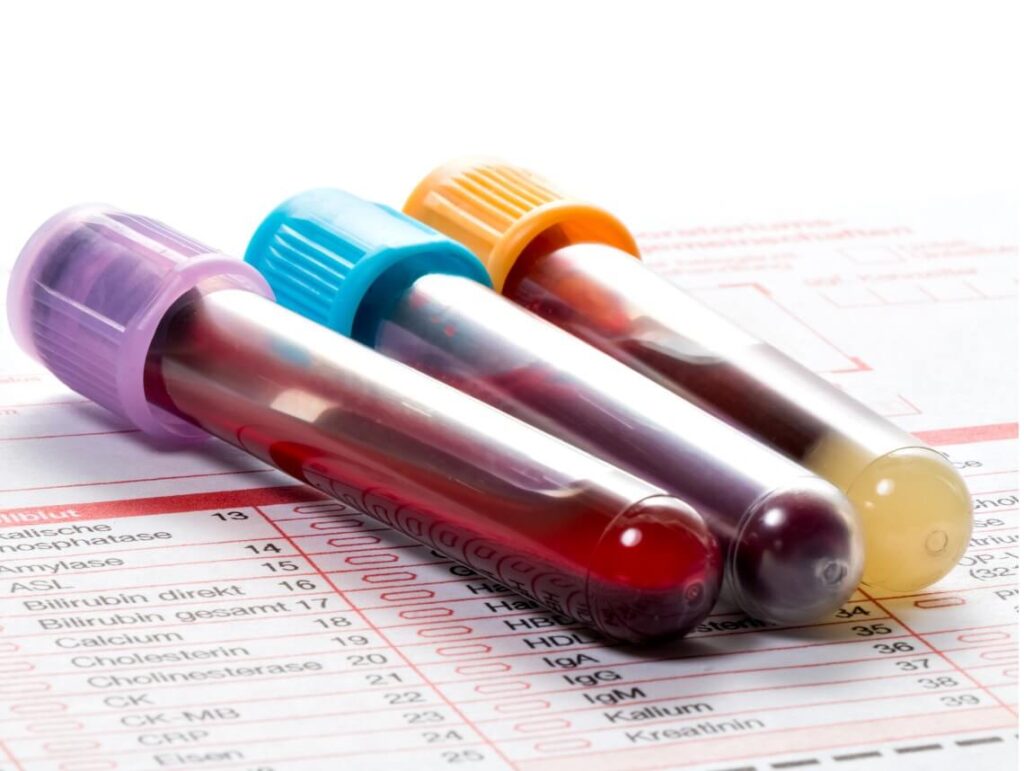 Hypopituitarism in Children