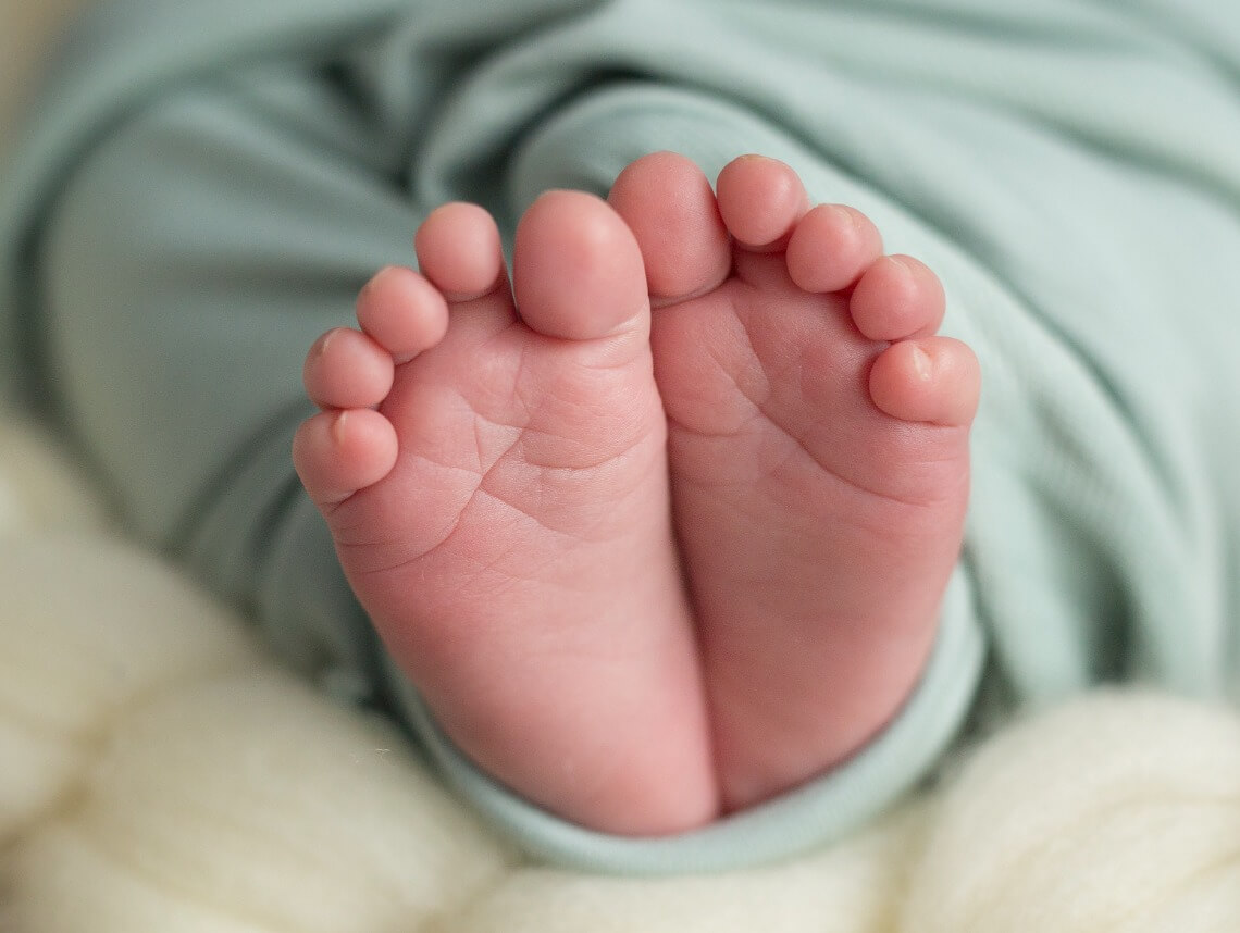 Hypotonia in Babies