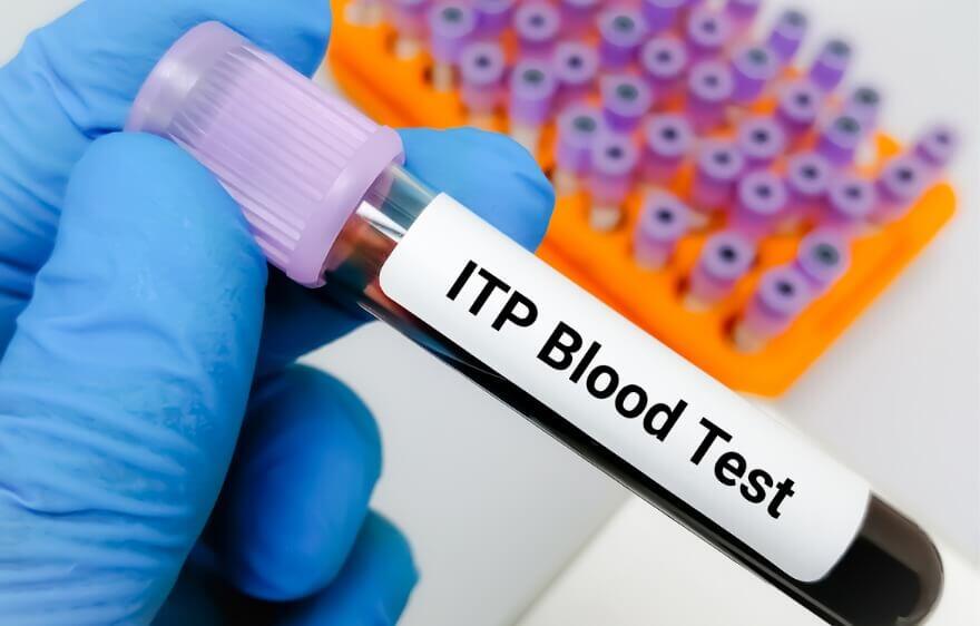 Immune Thrombocytopenia (ITP) in Children