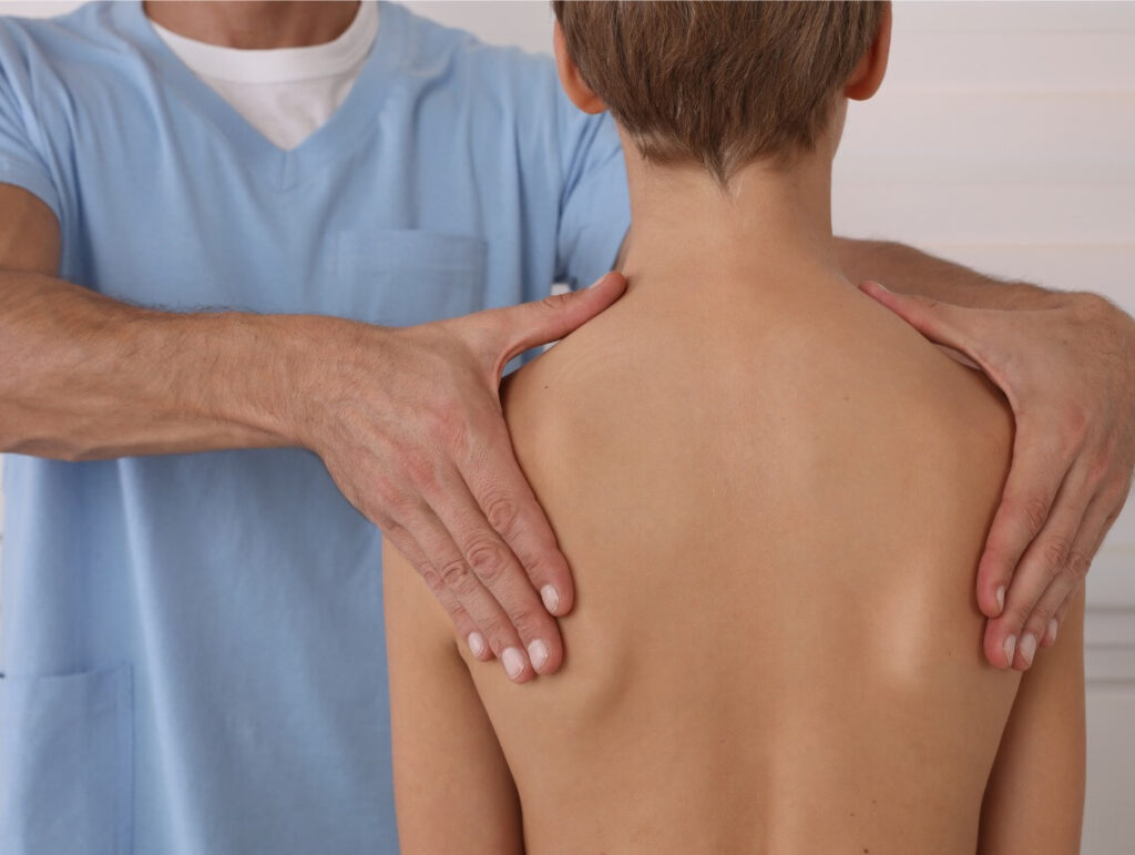 Kyphosis in Children