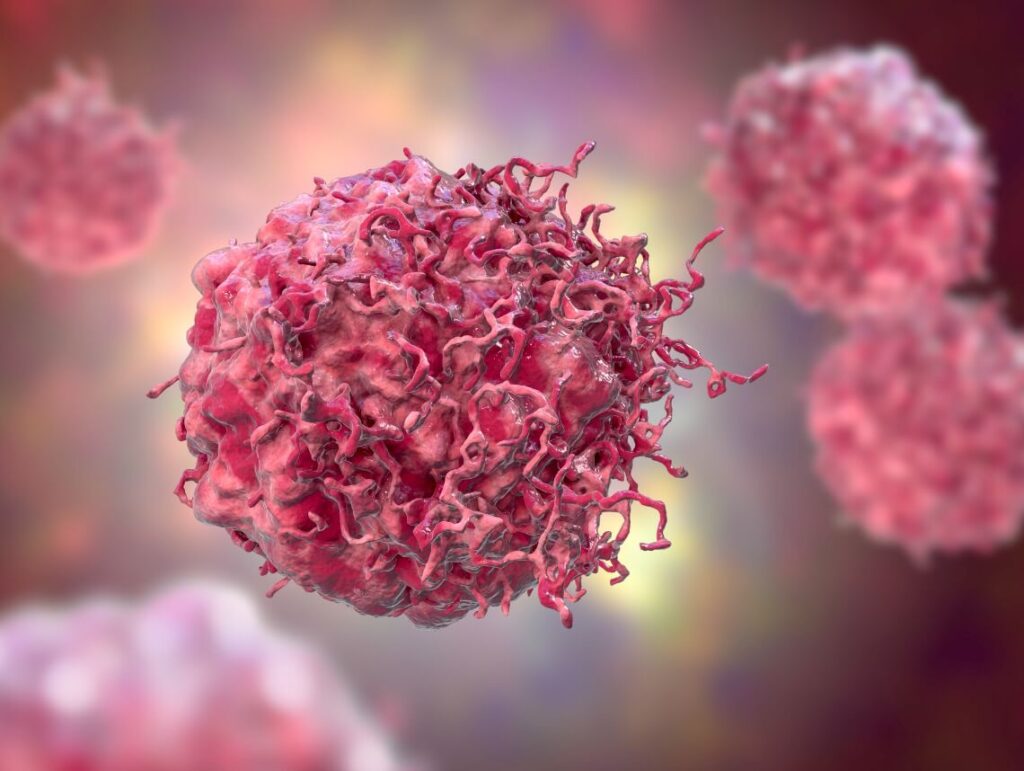 Neuroblastoma in Children