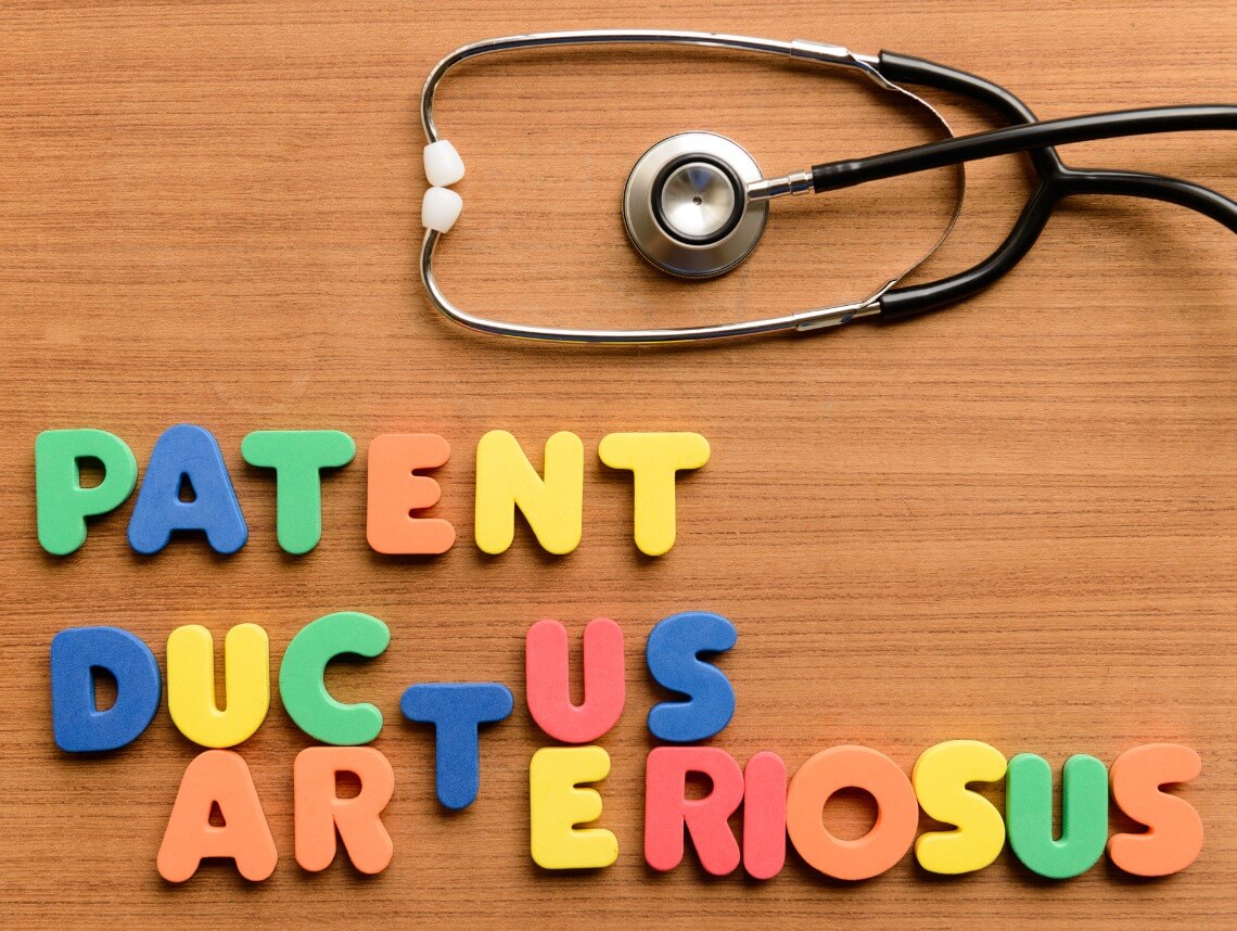 Patent Ductus Arteriosus in Children