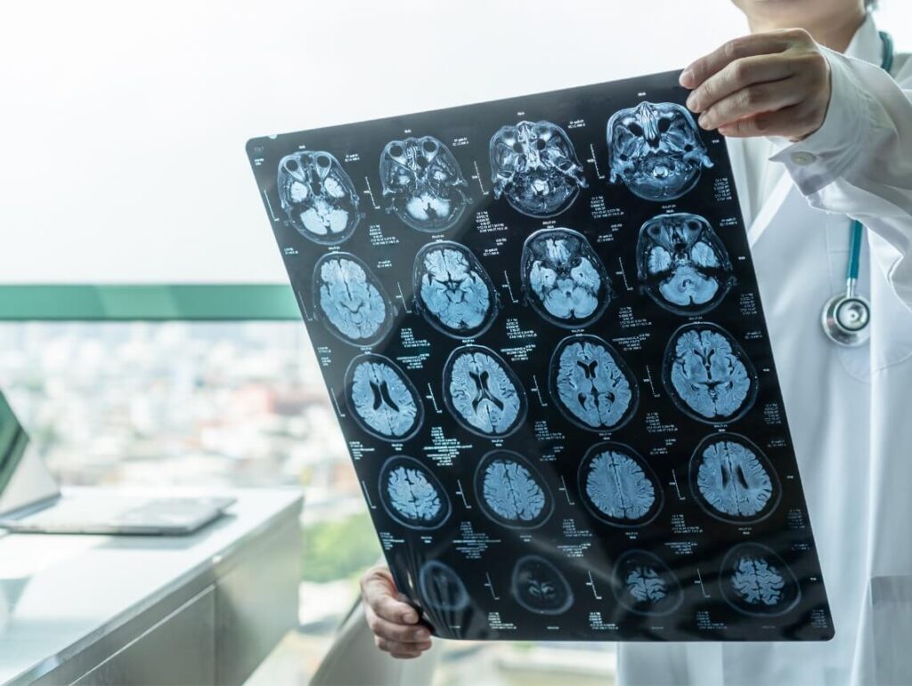 Pediatric Anoxic Brain Injury