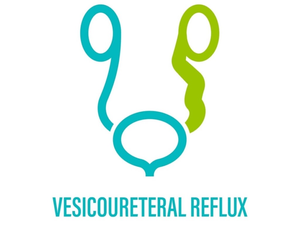 Pediatric Vesicoureteral Reflux (VUR)