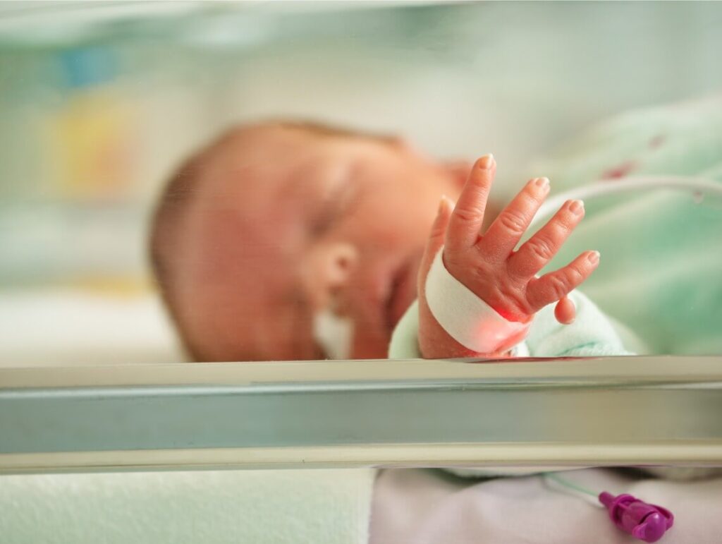 Polydactyly in Children