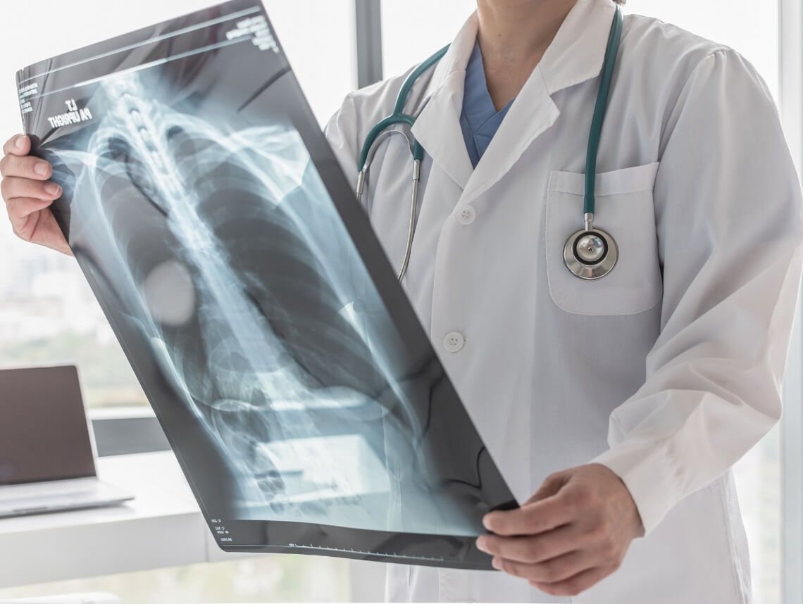 Pulmonary Hypertension in Children