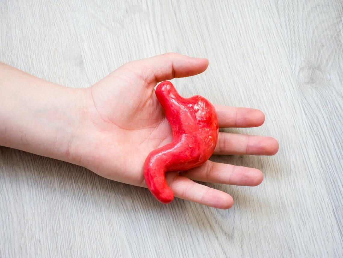 Pyloric Stenosis