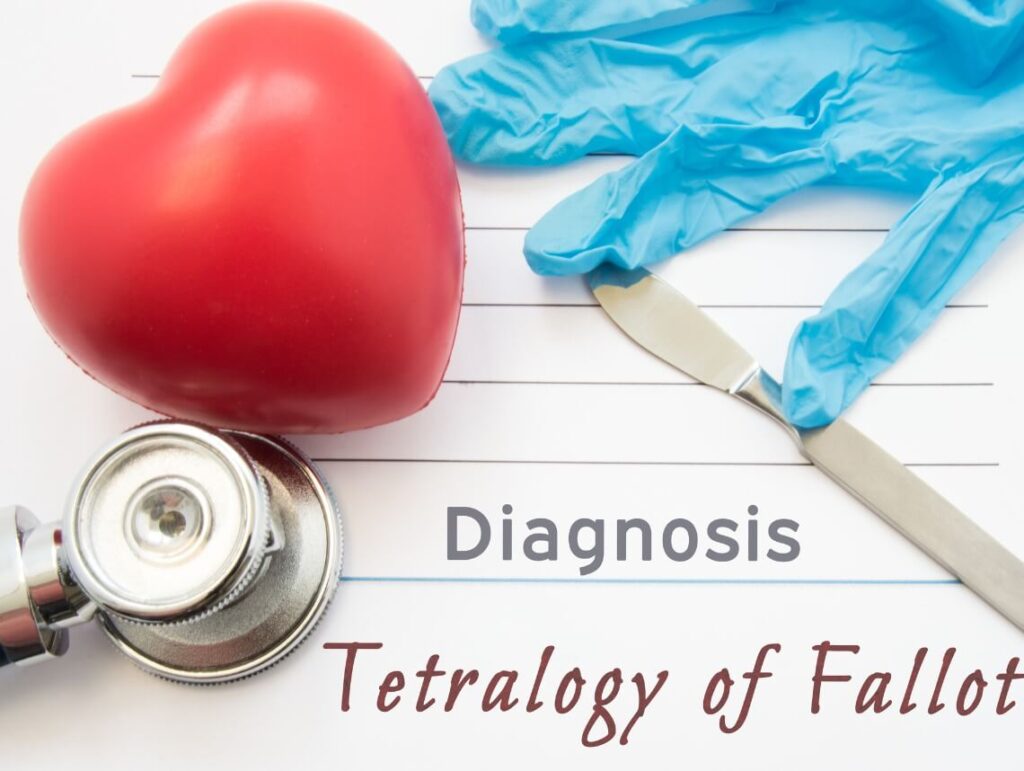 Tetralogy of Fallot
