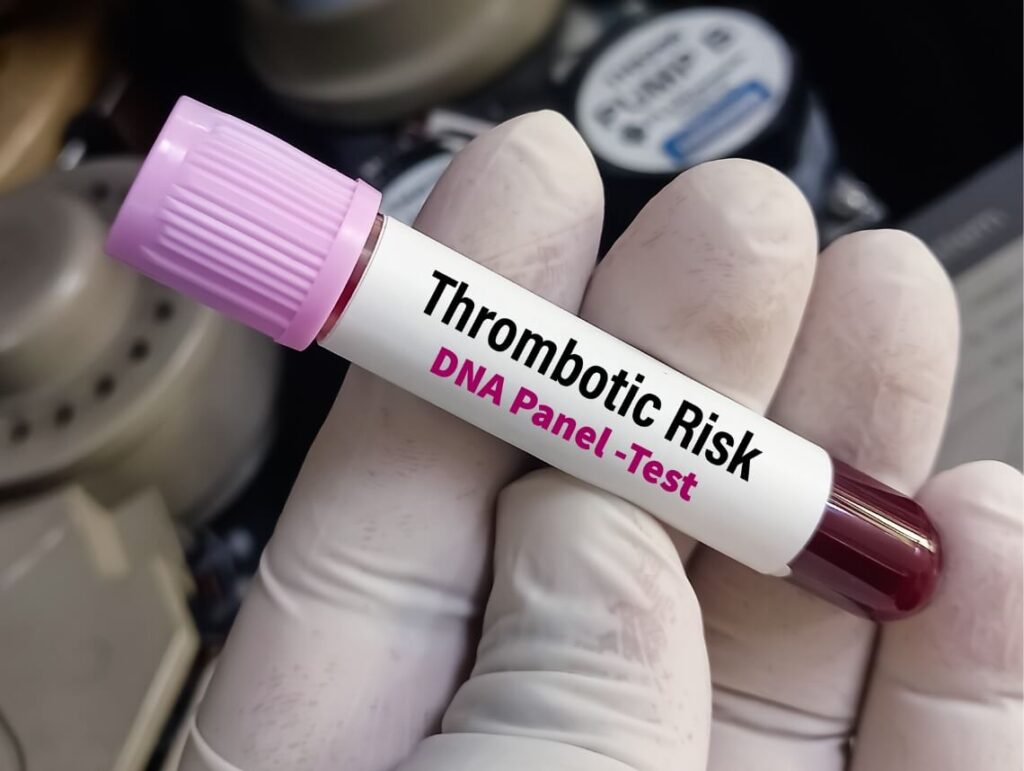 Thrombophilia in Children