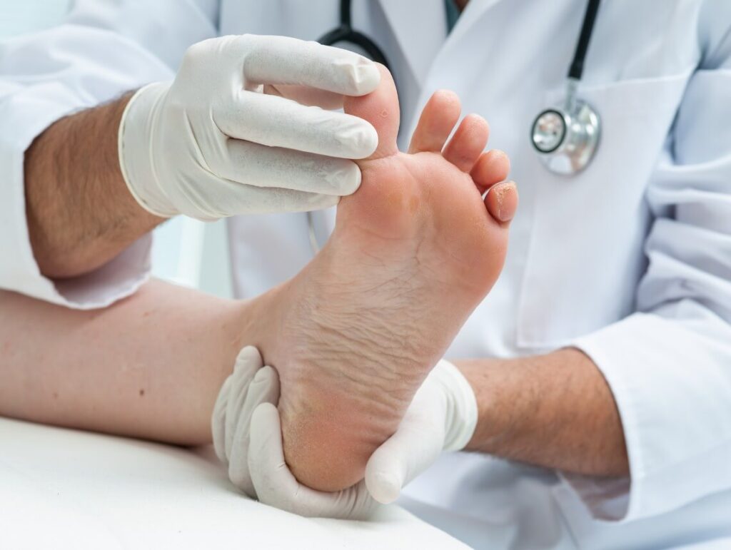 What is Diabetic Neuropathy?
