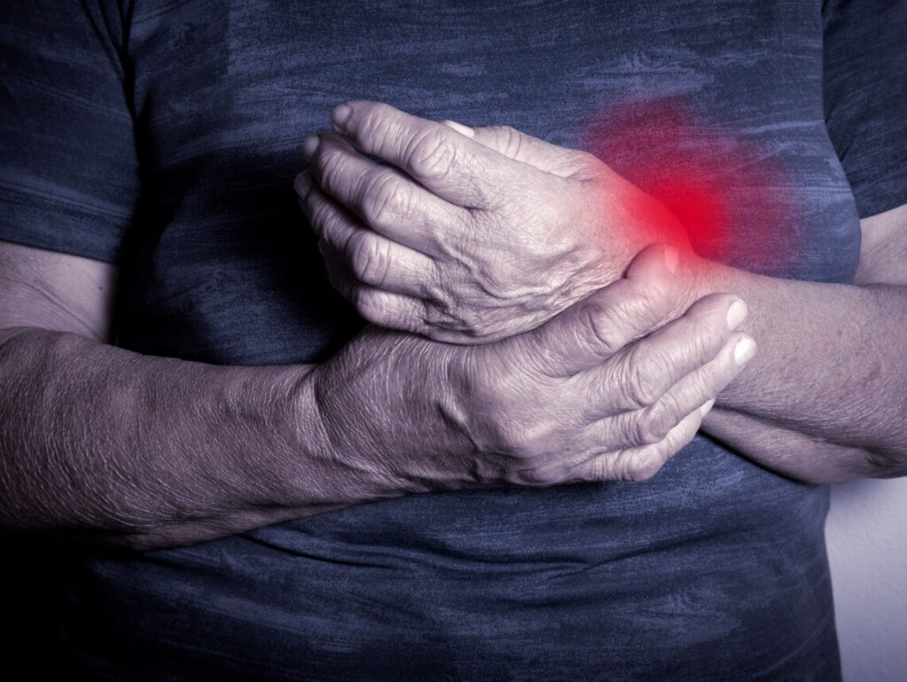 What Is Rheumatoid Arthritis?