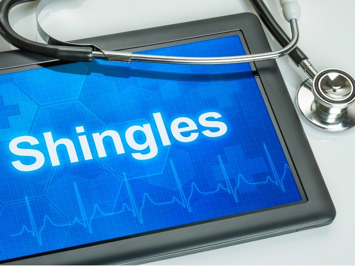 Shingles