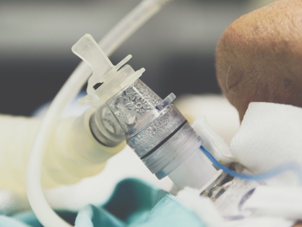 Tracheostomy Procedures