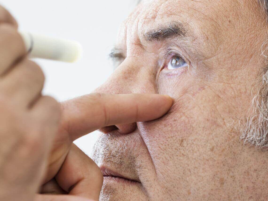 Cataracts: Symptoms