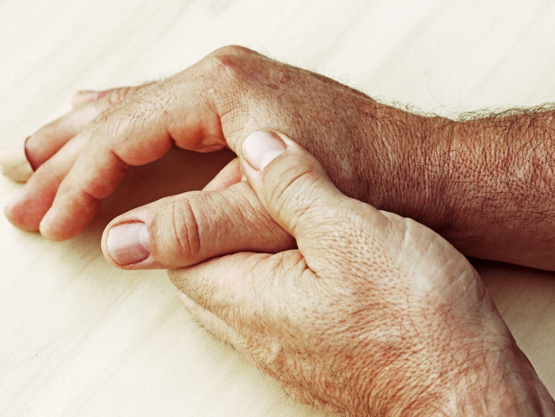 Psoriasis