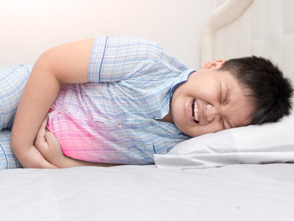 Abdominal Compartment Syndrome (ACS) in Children