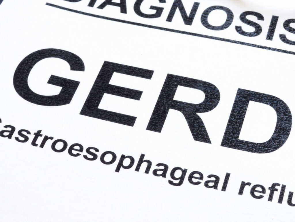 GERD in Children