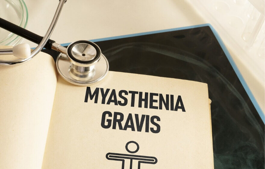 Myasthenia Gravis (MG)