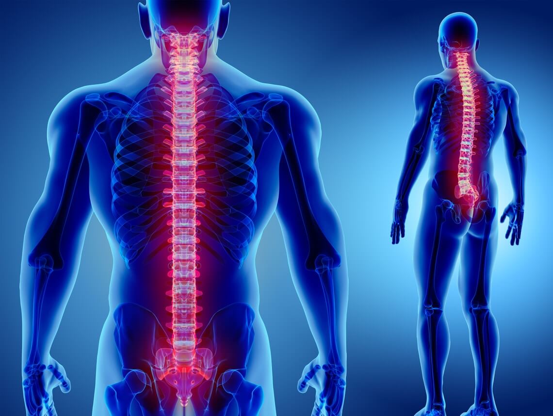 Osteoarthritis
